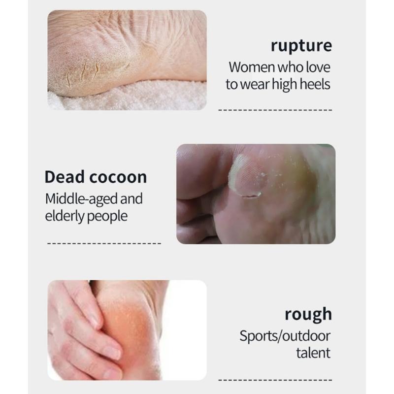 Rechargeable Two Head Callus Remover With Glass Abrasive Heads And Digital Display