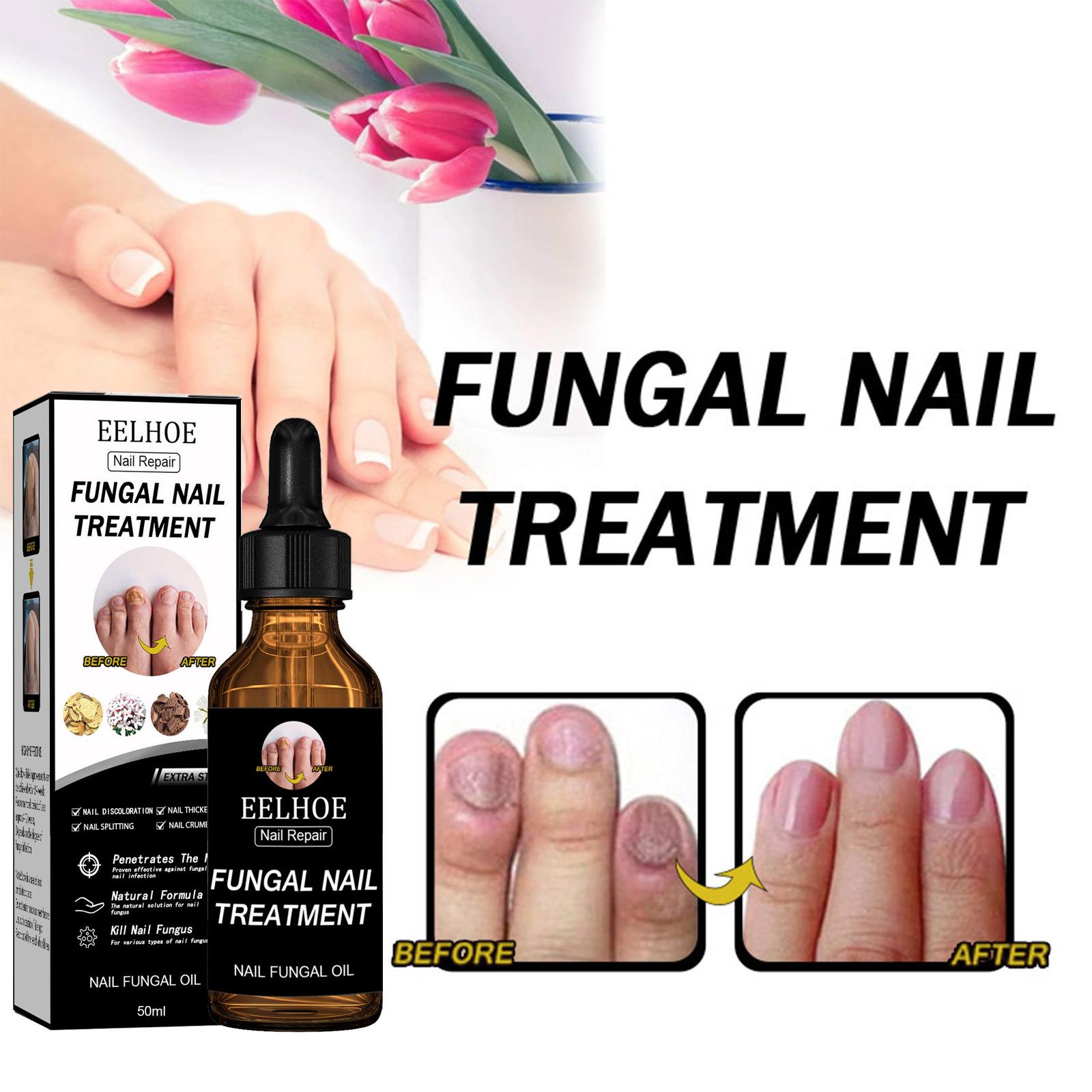 

EELHOE Revitalizer Tough on Nails: Nail Refresher Liquid for Discolored Nails