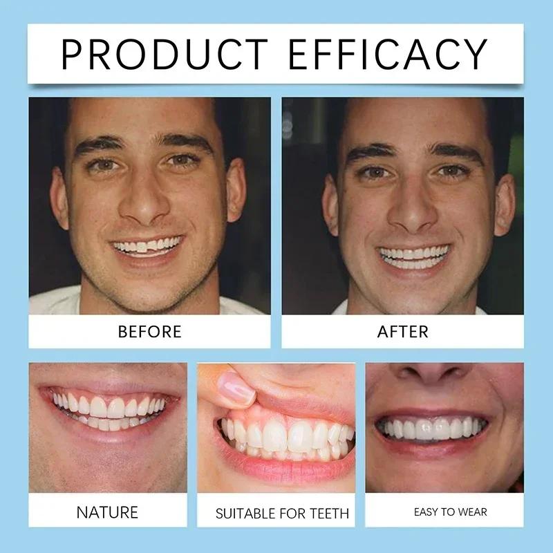 Cosmetic Denture Kit Temporary Tooth Cover To Hide Gaps Natural-Looking Smile Enhancement Aesthetic Teeth Improvement