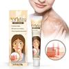 Vitiligo Cream, Natural Vitiligo Ease For Skin Vitiligo, Vitiligo Care Cream, Reduce Spots And Improve Skin Pigmentation, Easy To Use