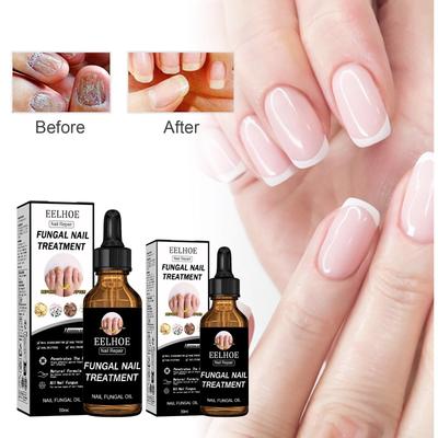 Nail Care Treatment - Moisturizing Nourishing Formula for Bright, Smooth & Hydrated Nails | Daily Nail Care