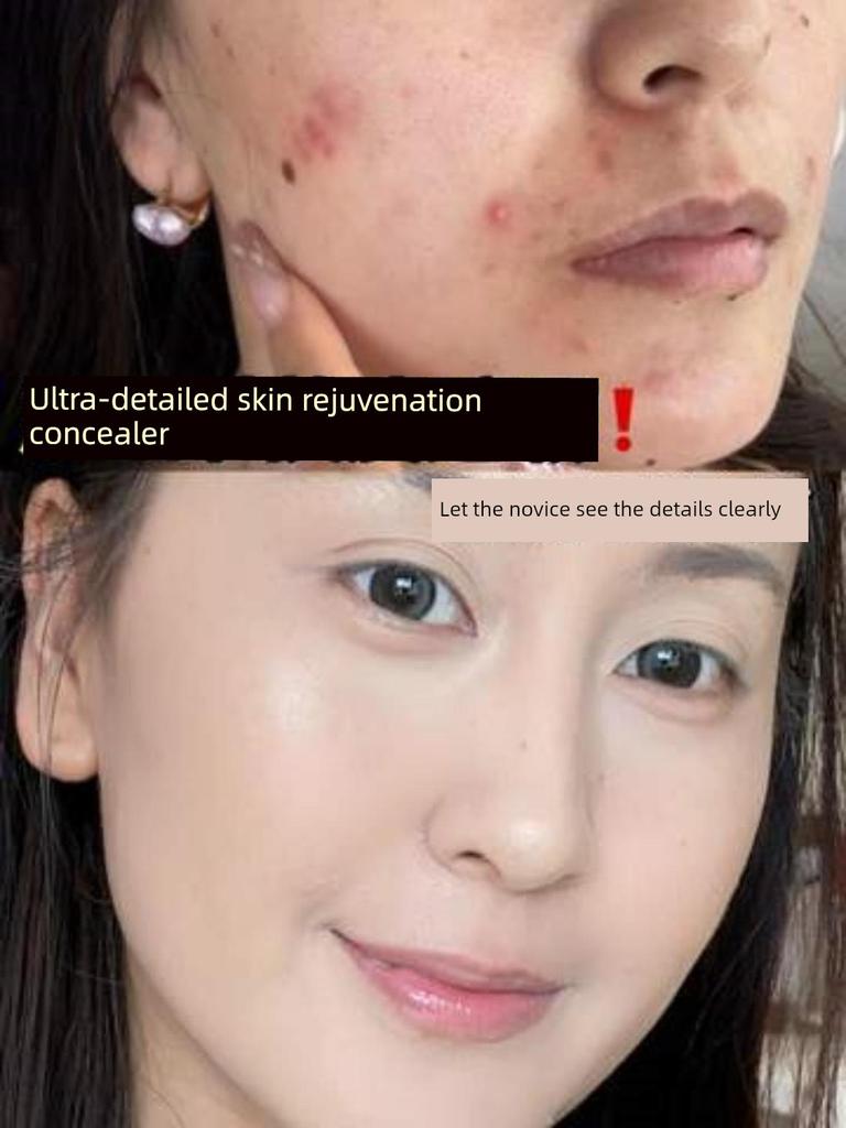 Three-Color Concealer to Cover Spots, Acne Marks, Dark Circles, and Eye Bags, Without Caking or Smudging, Brightens Tear Troughs