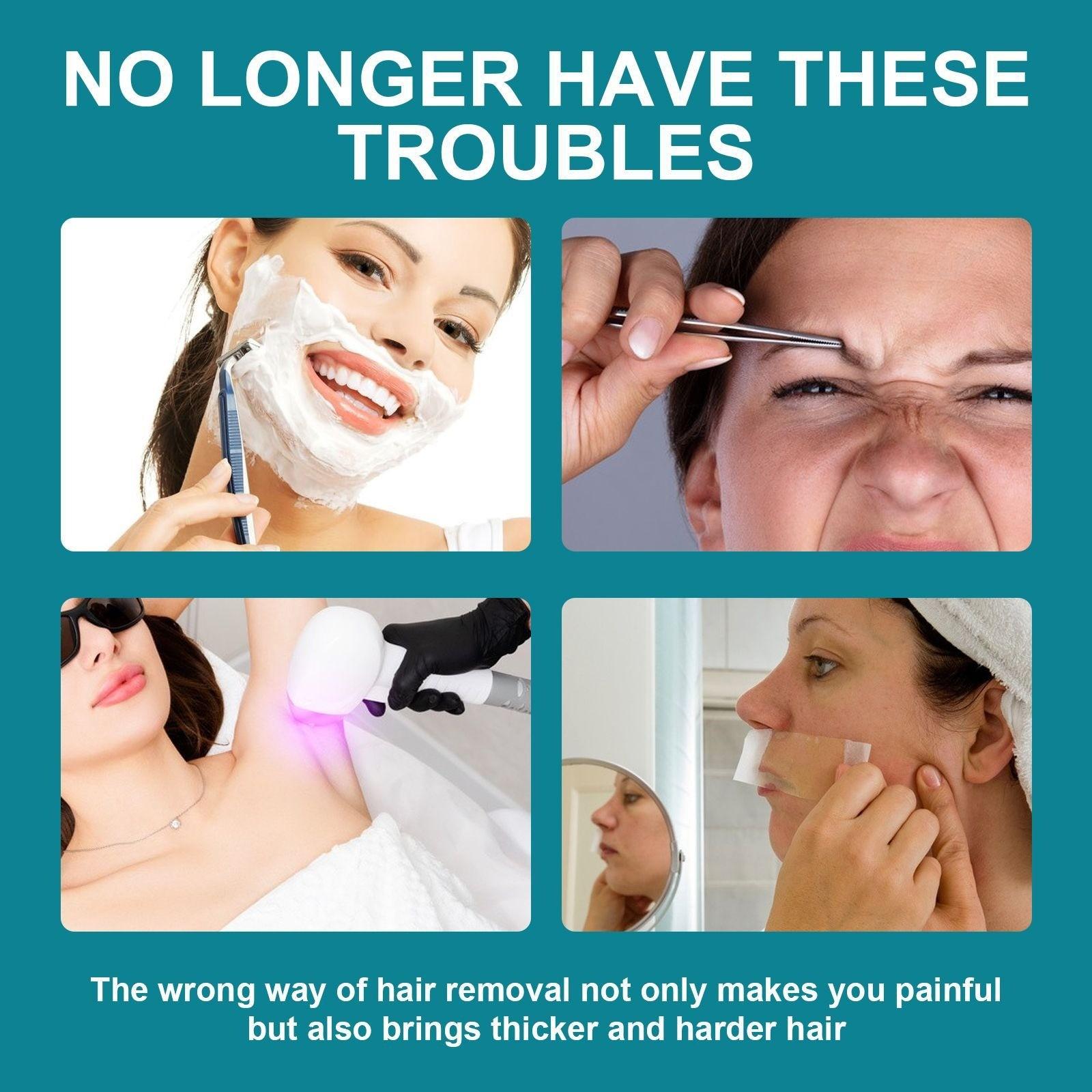 Удаление волос на лице — фото 6