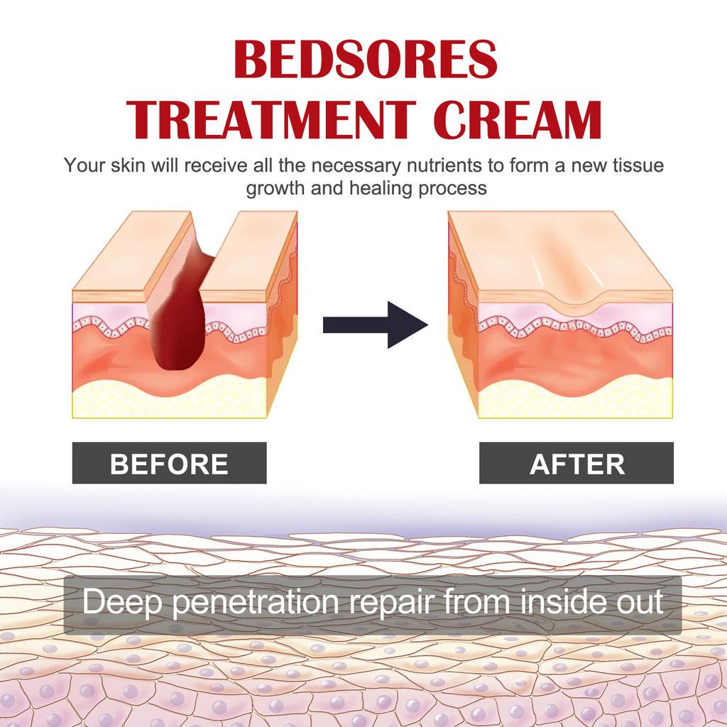 Eelhoe Deep Moisturizing Skin Barrier Cream For Dry Skin Care