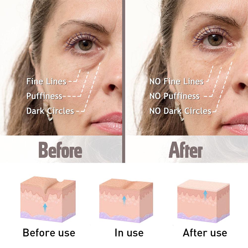 Okamžité odstranění očních váčků Krém, Retinolový krém, Proti otokům, Vráskám, Stárnutí, Stahuje kruhy, Oddaluje Redukuje Tmavý Gel