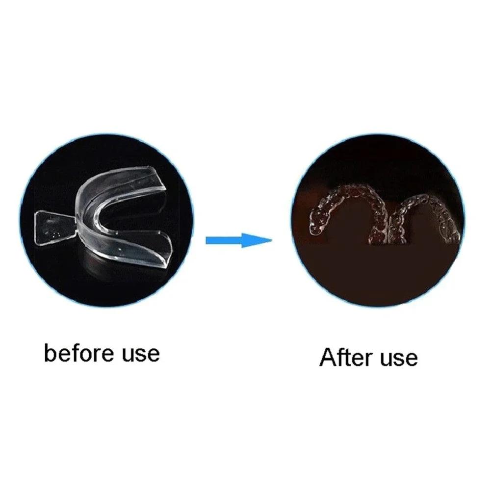 1/4PCS Anti Snoring Bruxism Sleeping Mouth Guard Tray Stop Teeth Grinding Sleep Aid Night Guard Gum Shield Mouth Health Care