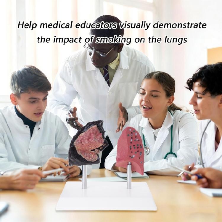 Anatomically Accurate Smoker Lung Comparison Model With Healthy Lung PVC Substance For Clinical Education
