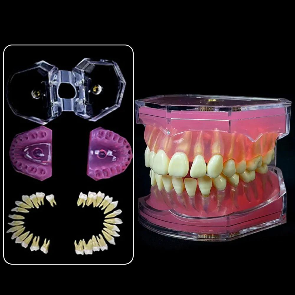 Dental Model Standard Teaching Typodont Soft Gum Teeth Model Training Teeth Jaw Models 28 Removable Teeth Dentistry Lab Model
