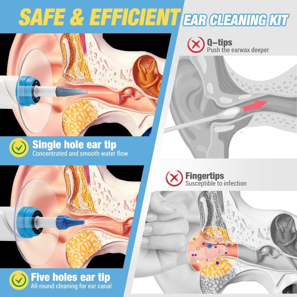 Multifunktionaler Elektrischer Ohrwasserreiniger Ohrenschmalz Ohrenschmalz Entfernung Spülsystem Haushalt Tragbares Ohrreinigungsgerät