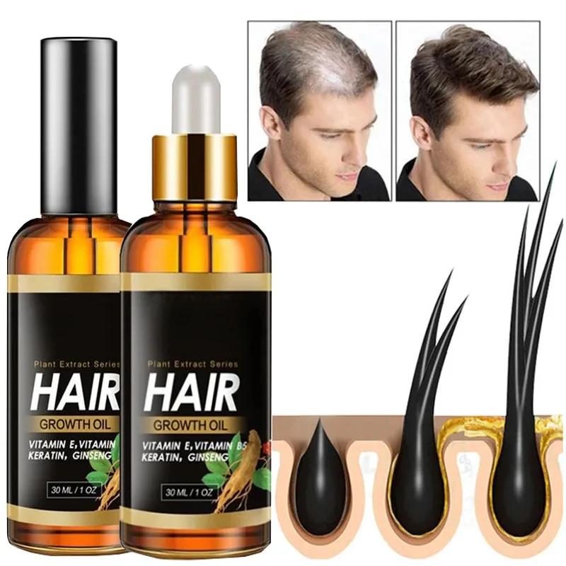 Produits en Spray Anti-Chute de Cheveux Sérum Capillaire Huile Essentielle Traitement au Gingembre Cheveux Secs Crépus Abîmés Nourrir