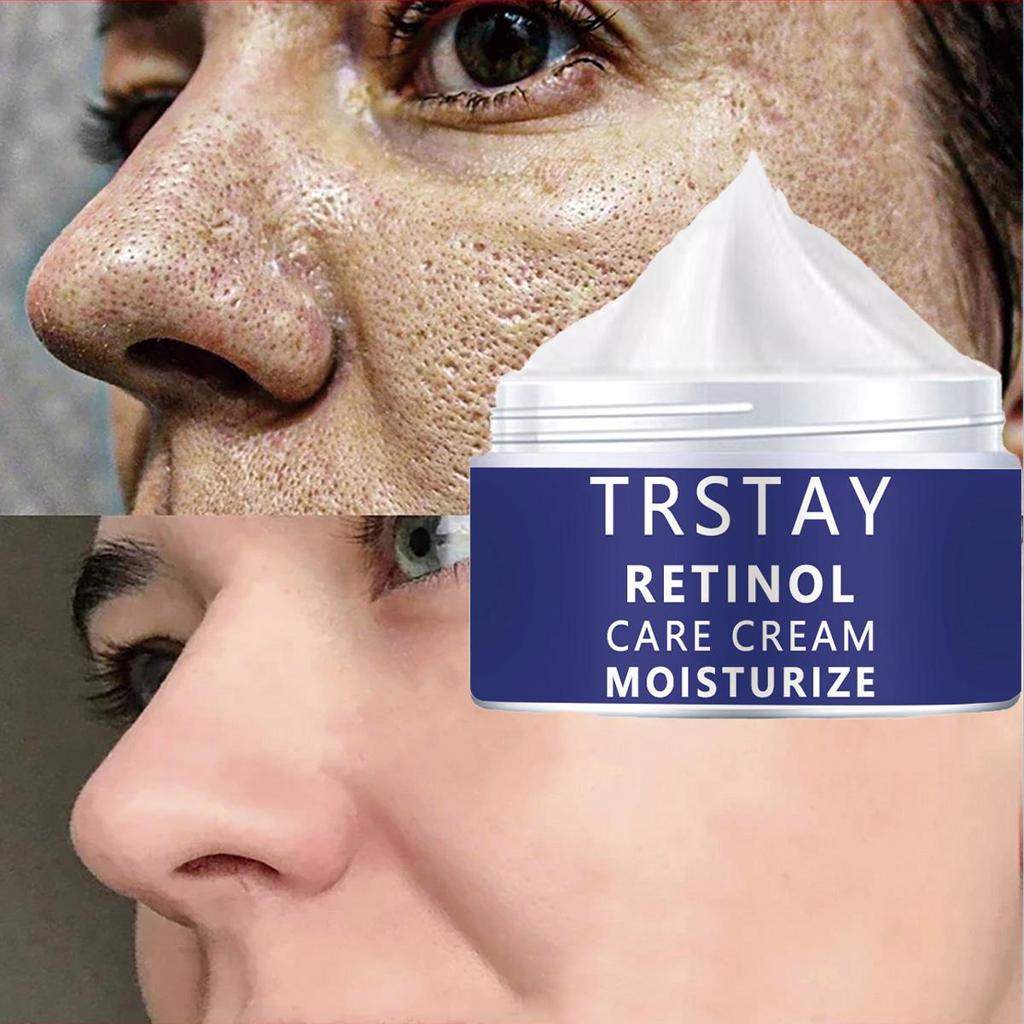 Hyaluronic acid cream that relieves skin discoloration, moisturizes and tightens the skin, making the skin look visibly vibrant and brightened