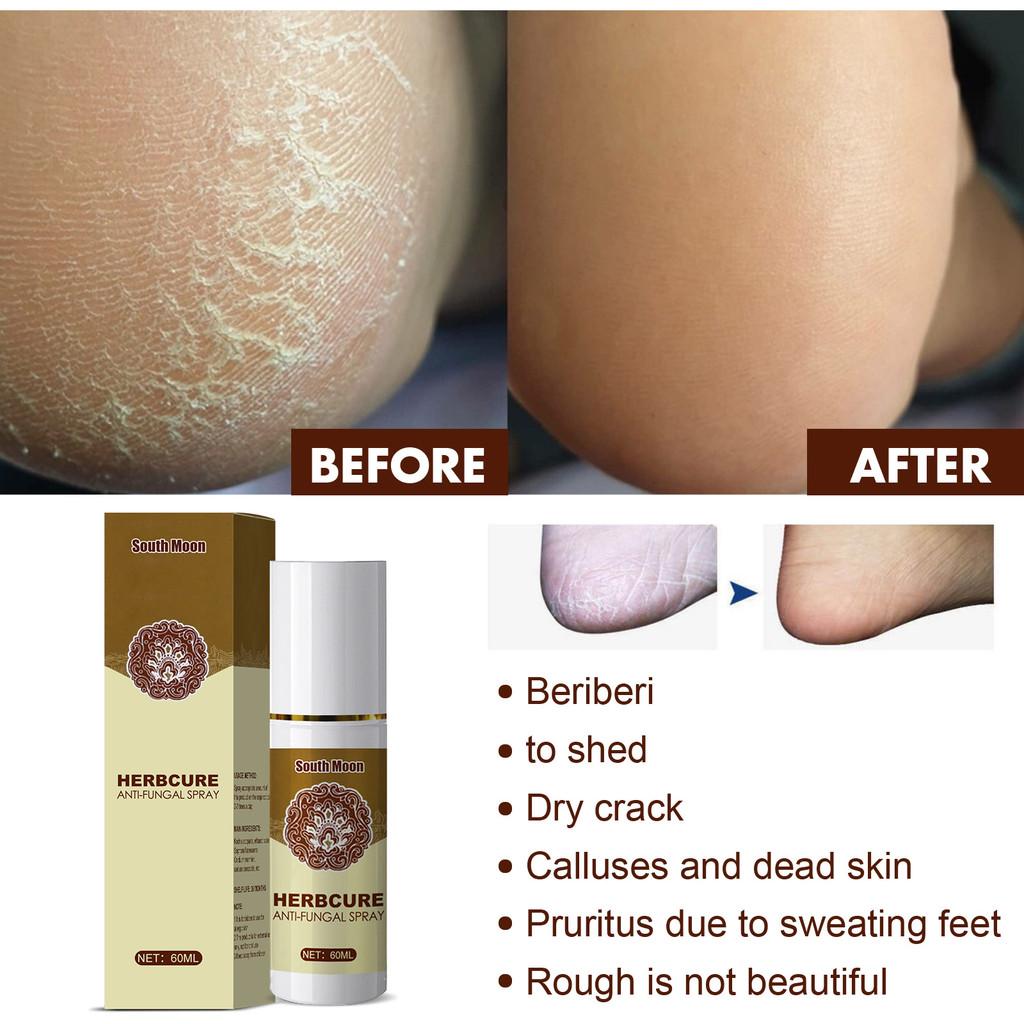 South Moon Herbal Foot Spray Refreshing Foot Odor Eliminator And Sweat Control 60ml