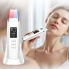 Ultrasonic Skin Scrubber EMS Vibration Face Spatula Blackhead Remover Shovel Clean Cavitation Peeling Facial Lifting Skin Care