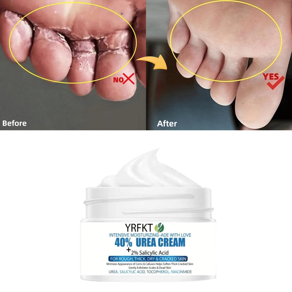 Výkonný hydratační krém na ruce a nohy, může zmírnit extrémní suchost, předcházet prasklinám a poskytovat dlouhotrvající hydrataci pro ruce a nohy.