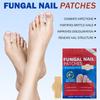 Foot Care Antibacterial Patch - Fungal Infection Recovery & Sterilization