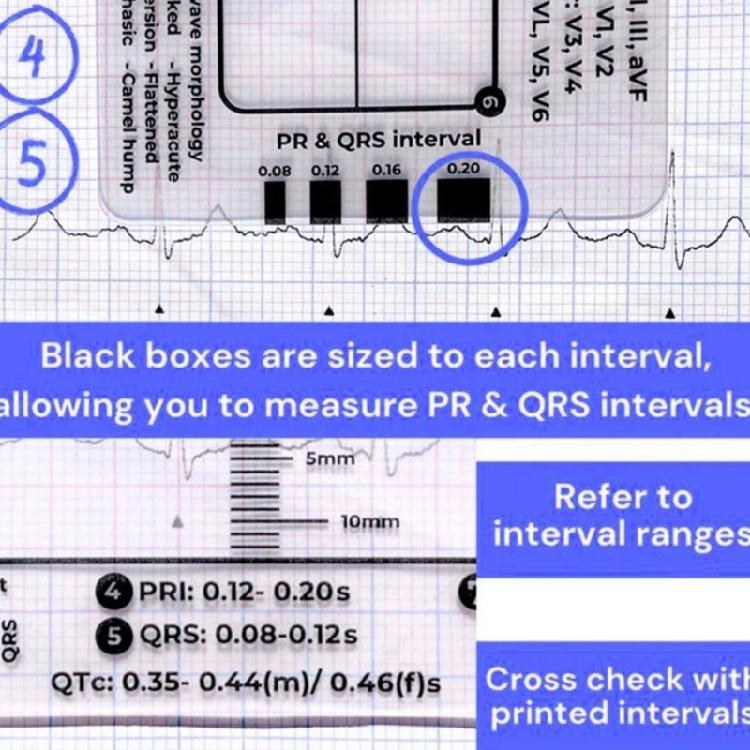 Electrocardiogram Assessment Tool 7 Step Ruler Card For Hospitals Clinics Healthcare Professional And Medicals Students