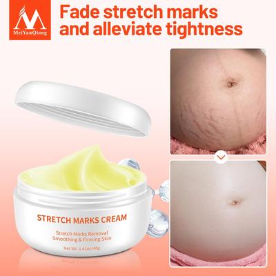 Stretch Mark Cream - Smoothes & Repairs Skin 40g