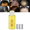 Nut Hair Growth Care Essential Oil Hair Loss Treatment Nourishing Essential Oil20ml