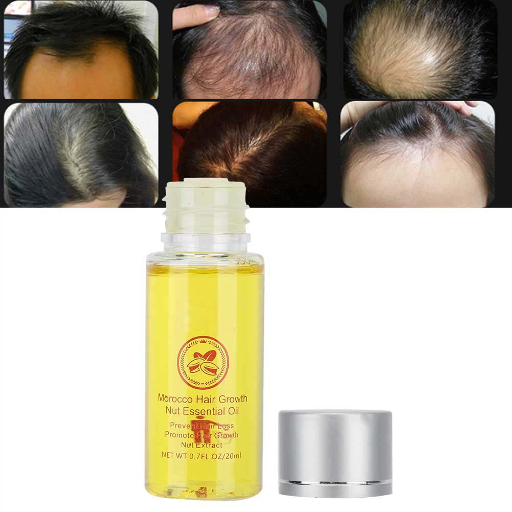 Nut Hair Growth Care Essential Oil Hair Loss Treatment Nourishing Essential Oil20ml