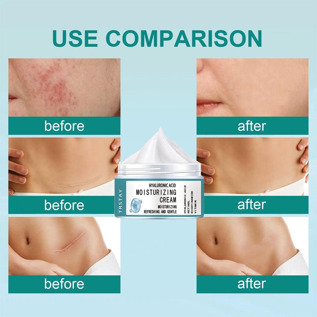 Moisturizer, Deep Care Improves the Appearance of Scars, Brightens the Complexion and Rejuvenates