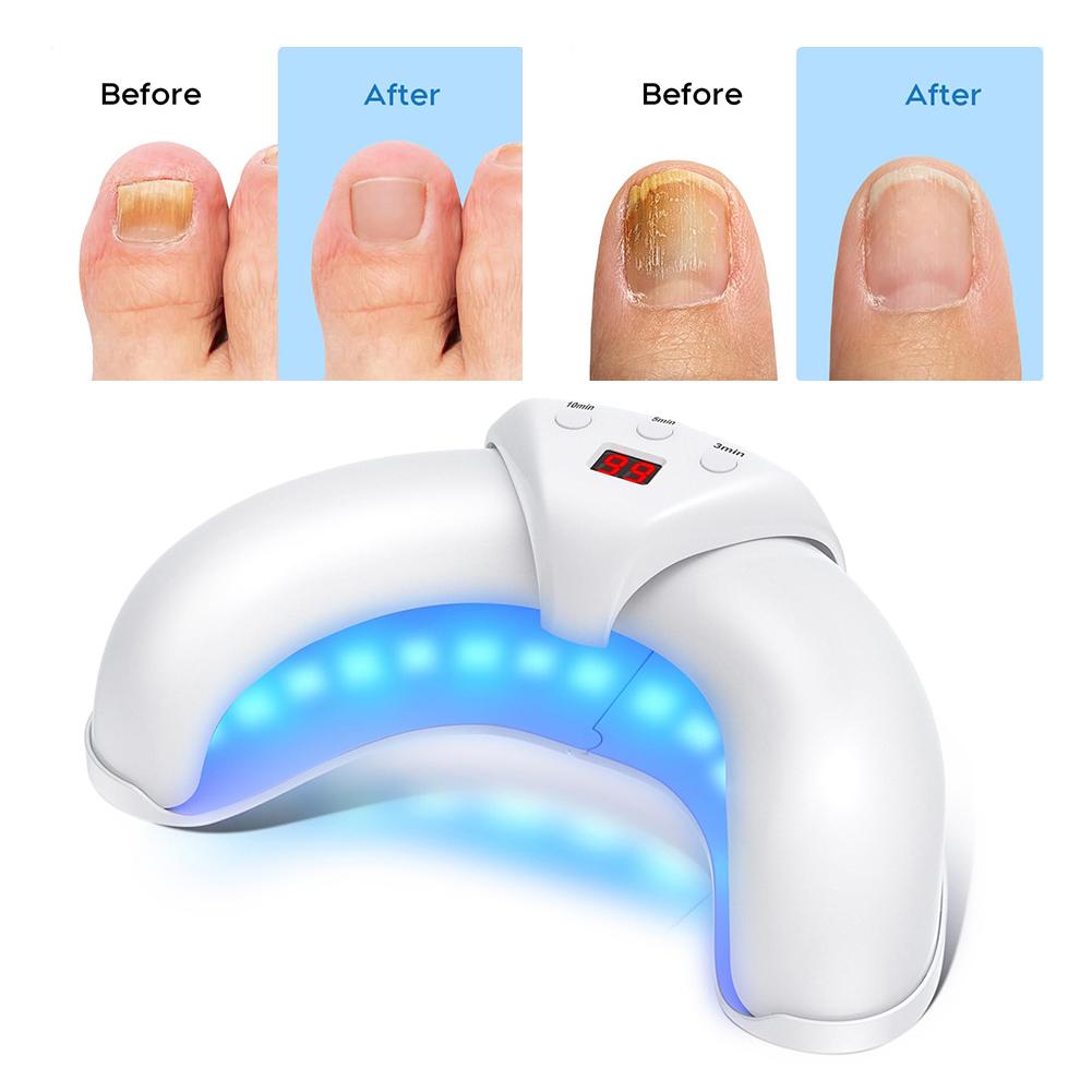 Wireless Nail Fungus Laser Device 45W 14pcs 470nm Blue Light 3-10 Minutes Toenails Anti Infection Paronychia Onychomycosis Care