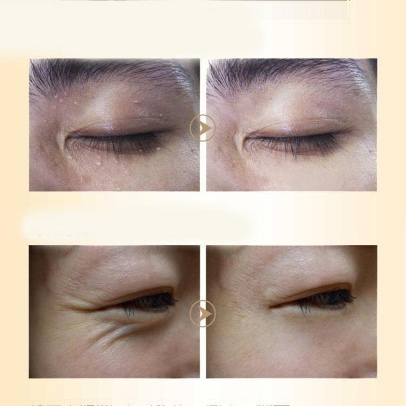 Koňský olej zpevňující oční krém na tmavé kruhy a vrásky a tukový granulát a oční esence proti stárnutí Odstraňte oční krém s tmavými kruhy(5g/15g/30g/50g)