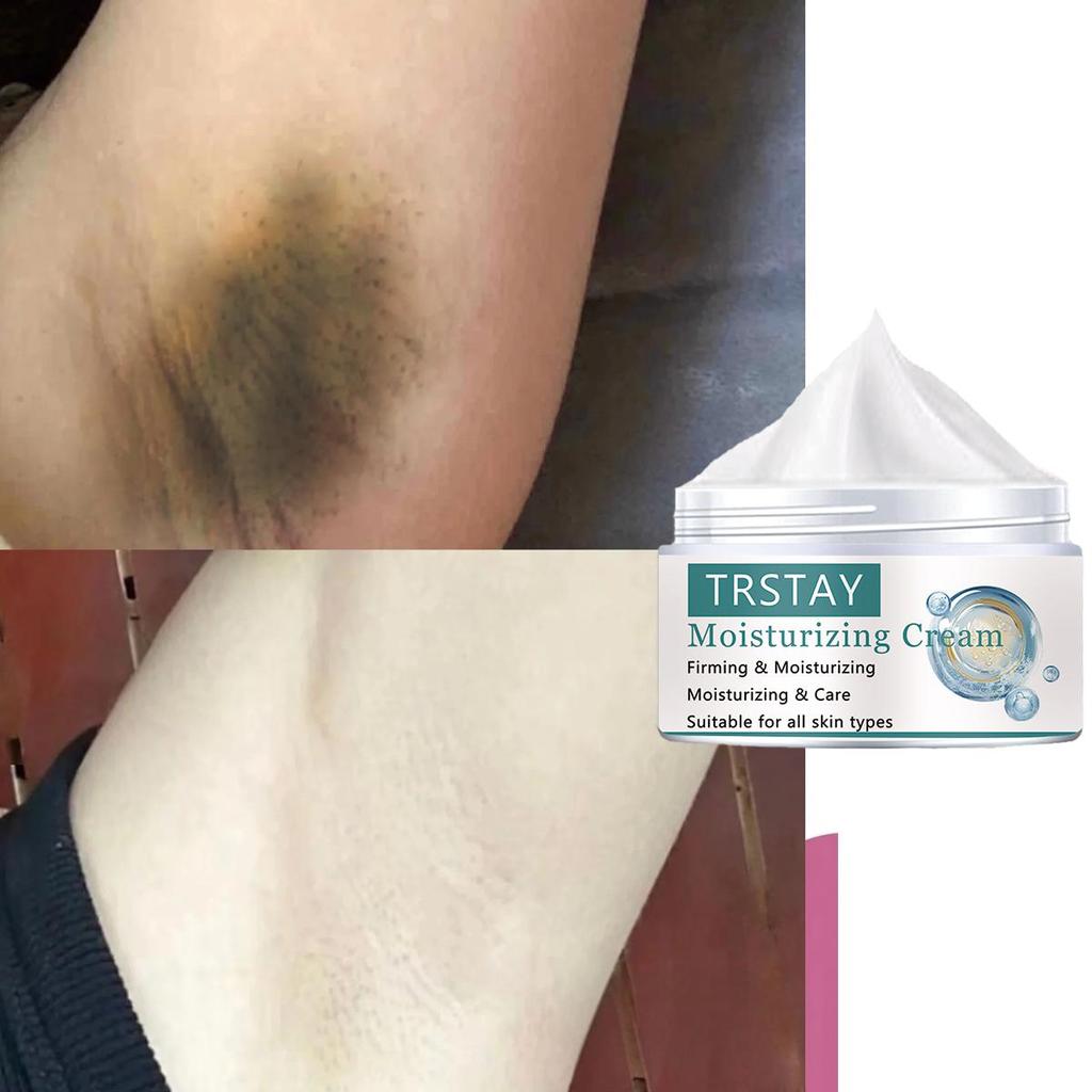 Whitening and Blacking Skincare Cream Nourishes the Skin, Evenly Brightens the Complexion, Replenishes Moisture, and Moisturizes the Skin