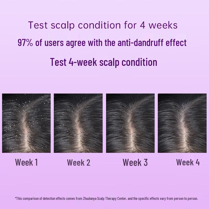 Zhuolanya Qiji Heavy Duty Anti-Dandruff Shampoo