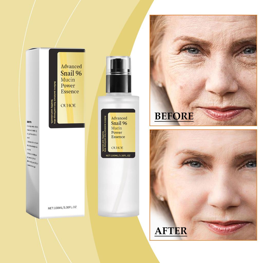Snail Moisturizing Toner Hydrating Improve Dry Skin Glow Nourishing Face Essence