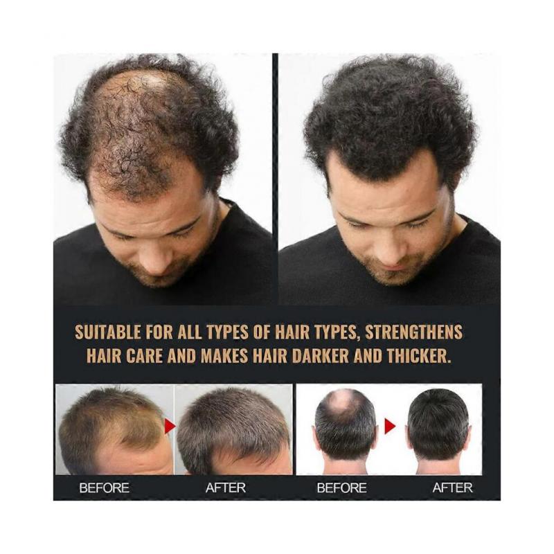 Spartan Shampoo Spartan Root Activator Shampoo Natürliche Haarwuchs Shampoos