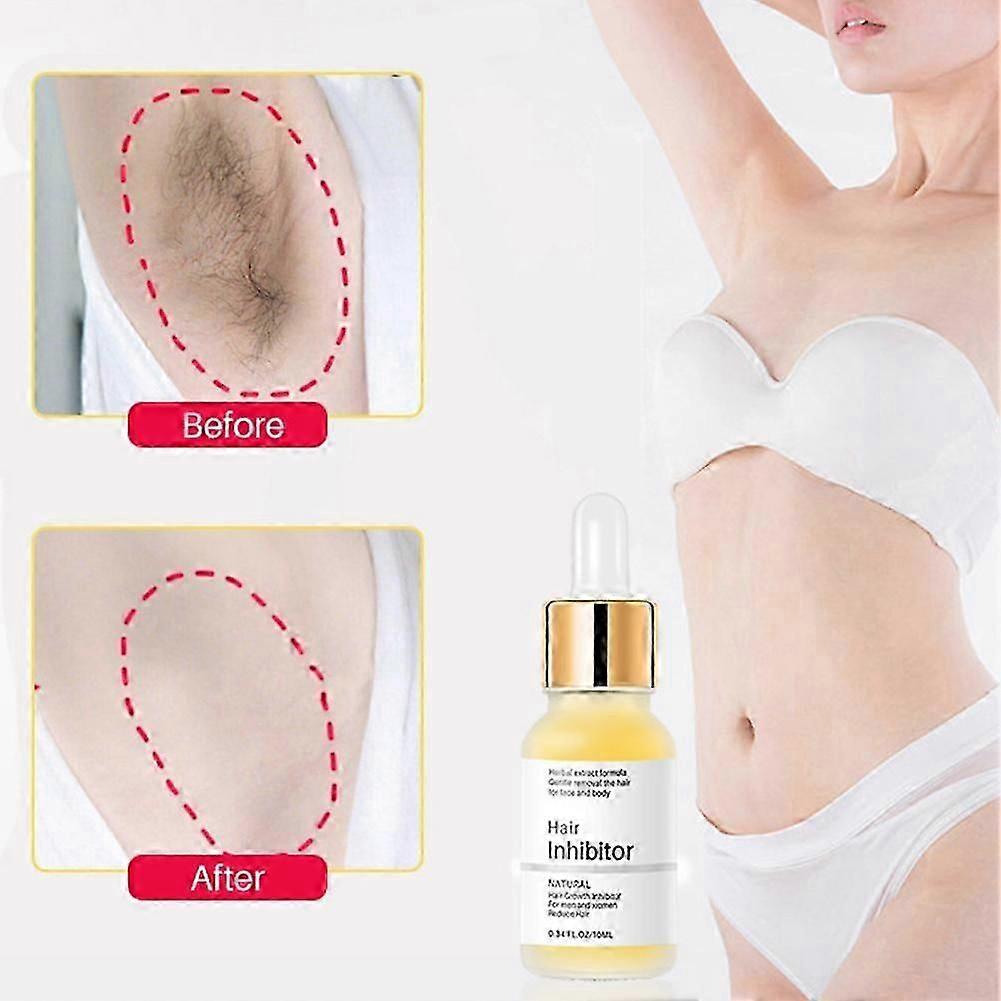 10ml(A)$ Mild hair nourishing liquid 10ml dropper bottle to inhibit hair loss body care