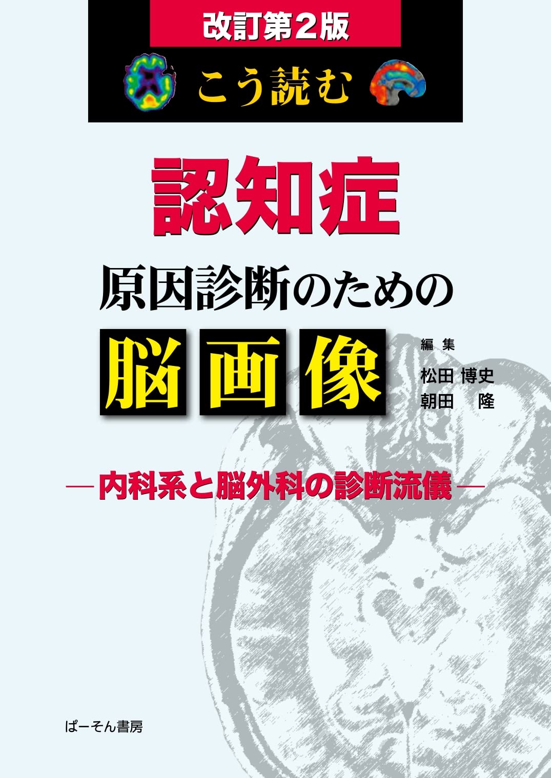 How to Read Brain Imaging for Diagnosing the Causes of Dementia: Diagnostic Approaches from Internal Medicine and Neurosurgery
