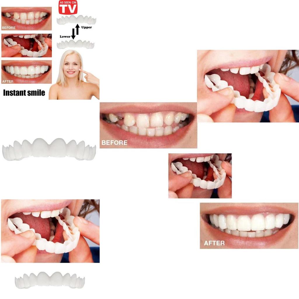 Instant Comfort Smile Cosmetic Teeth Denture Teeth Top Veneer Cosmetic