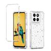 For ZTE Blade A35/A55 Case Clear Acrylic TPU Hybrid Phone Cover with Laser-printed Film