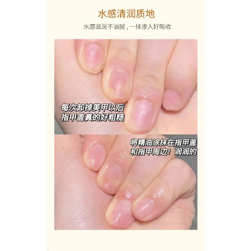 Hydrating Nourishing Hand And Foot Essence Oil Anti Dry Crack Moisturizing Skin Care