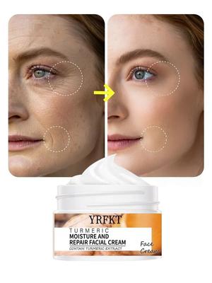 Crema facial reparadora de piel con cúrcuma, tratamiento para el acné, crema hidratante facial, blanqueadora, aclarante y eliminadora del acné