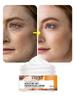 Turmeric Facial Skin Repair Cream Acne Treatment Face Moisturizer Whitening Lightening Against Acne Remover Cream