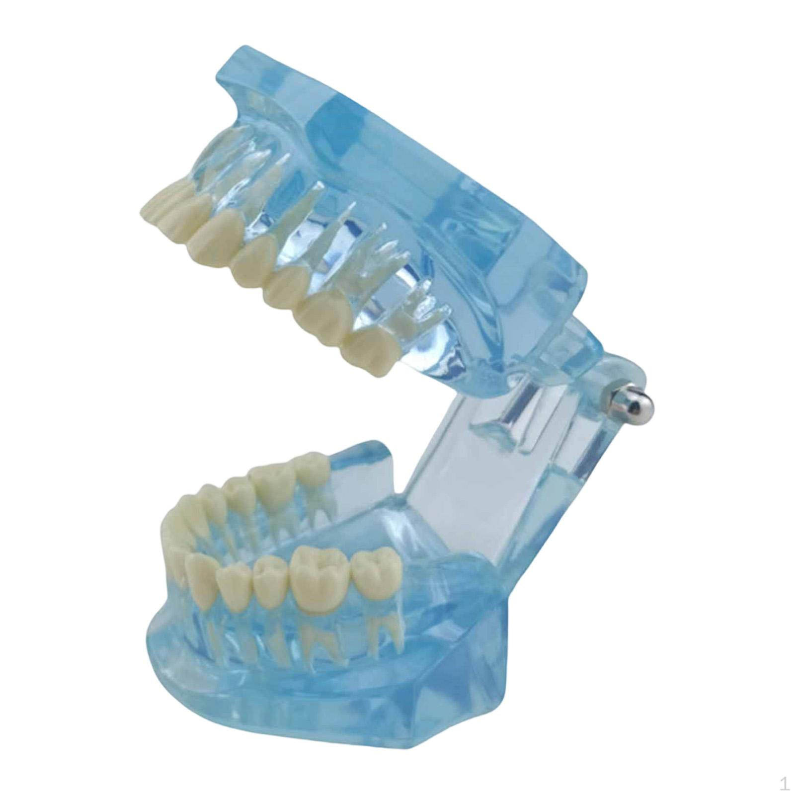 

Dental Demonstration Teeth Model Observation Portable Removable Orthodontics Blue