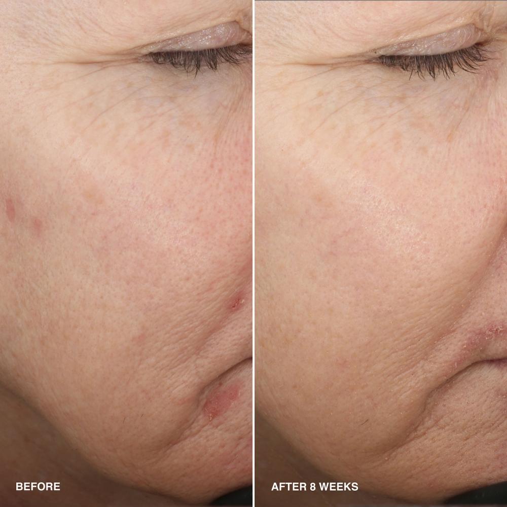 Bobbi Brown Vitaminangereichertes Glättendes Serum Mit Niacinamid + Vitamin C 1.014 Unzen   30 ml 1.014 Unzen   30 ml