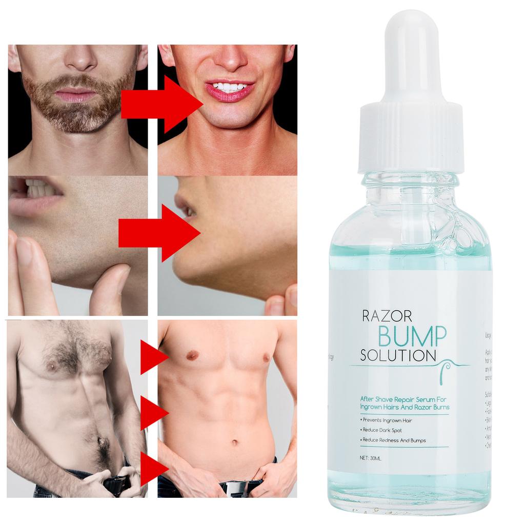 Lanthome Hair Growth Inhibiting Emulsion Moustache Grow Inhibitor Care Skin Cosmetic 30ml