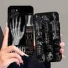 Radiological Human Organs Skeleton Phone Case For IPhone 17 16 15 14 13 12 11 Pro Max Plus Mini Soft Black Cover
