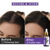 Sesa Rosemary Essential Oil 30ml For Hair Growth & Skin, Natural Hair Fall Control Oil For Men & Women, Pure Aromatherapy Diffuser Oil