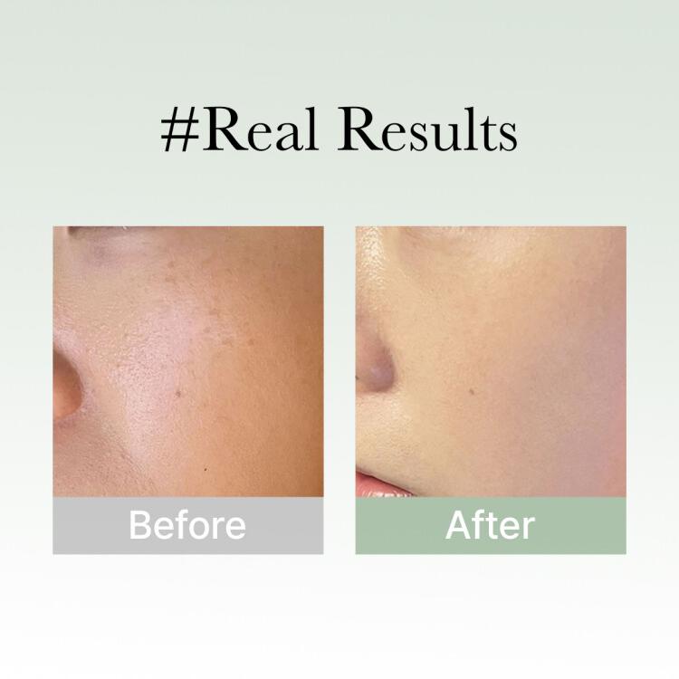 arencia Holy Hyssop Serum 30 50ml