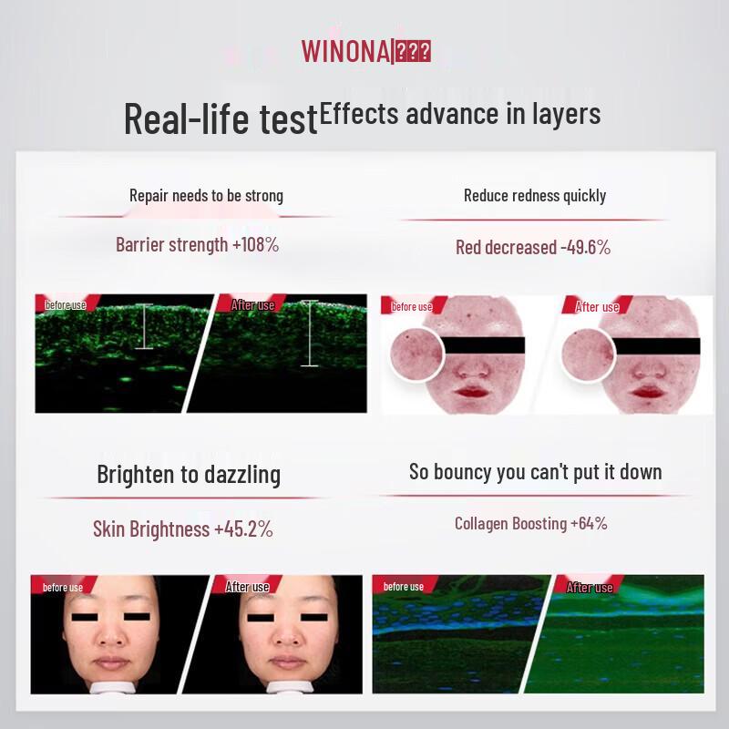 Winona 311 Barrier Repair Skincare Set