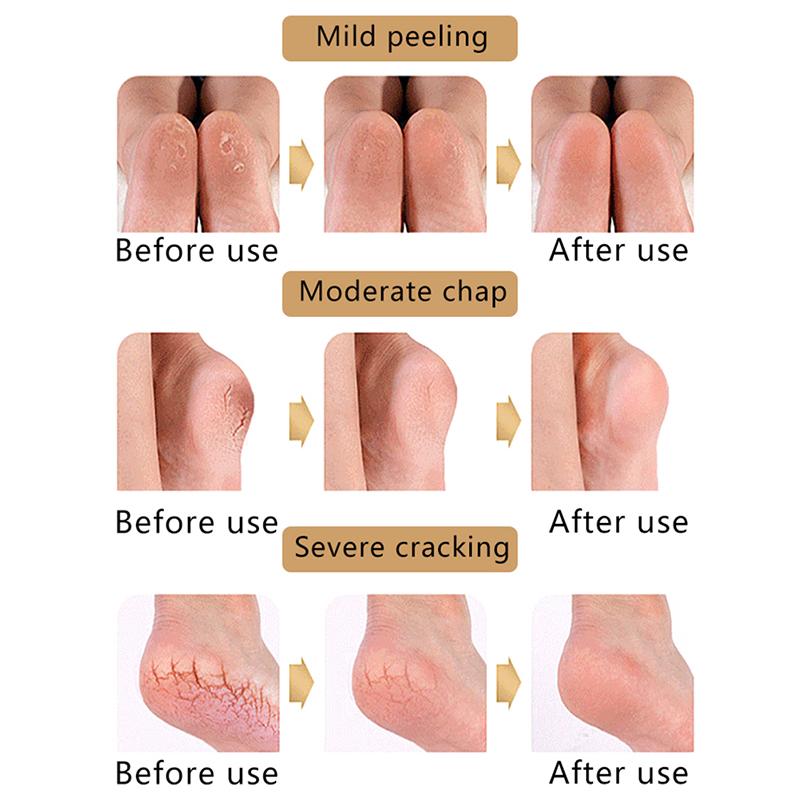 1 Pair Silicone Moisturizing Gel Heel Socks Cracked Foot Skin Care Protectors