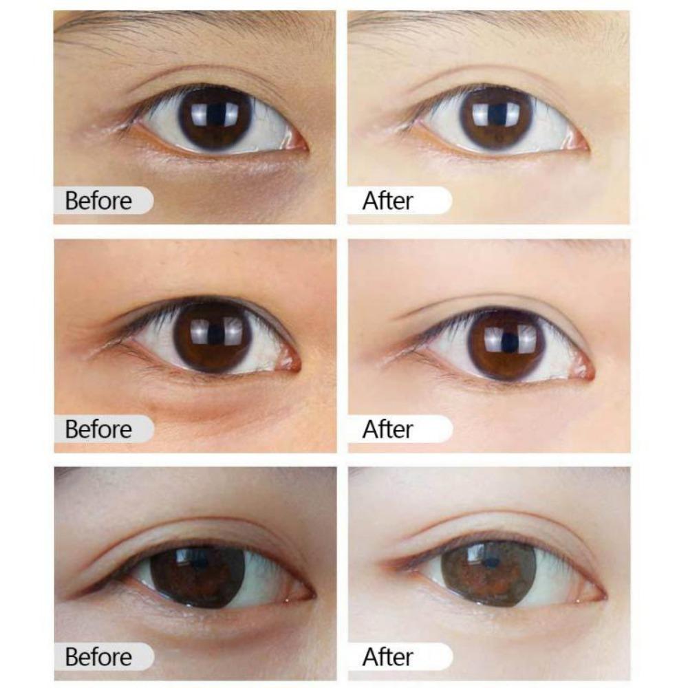 Hyaluronic Acid Roller Eye Essence Anti-puffiness Dark Circles Firming Skin Eye Serum Eye Care