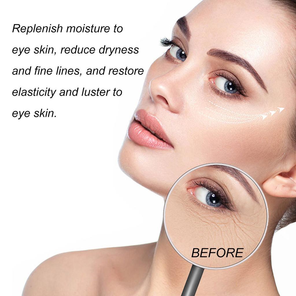Eelhoe Moisturizing Eye Masks For Reducing Fine Lines And Wrinkles With Hydrating Formula