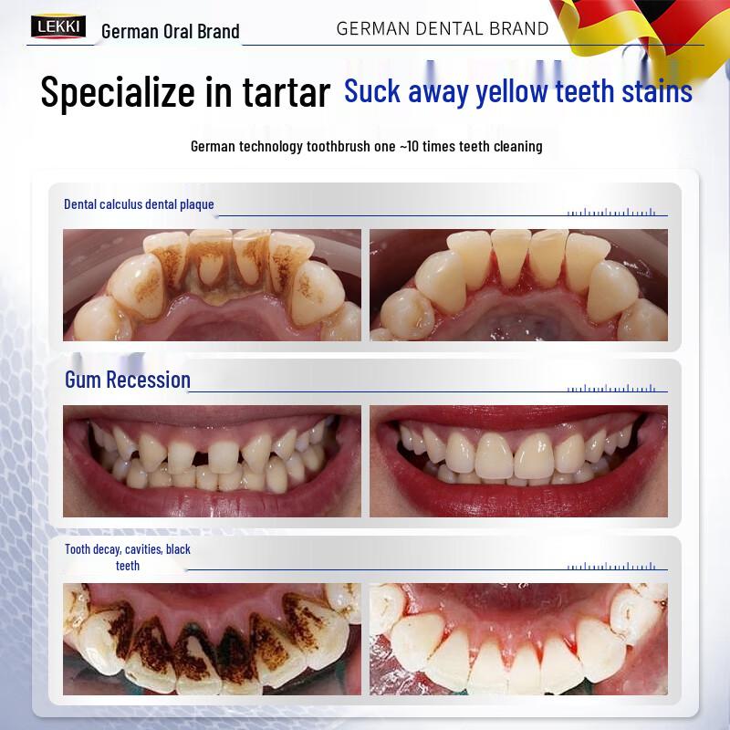 LEKKI Tartar Removal & Whitening Toothpaste