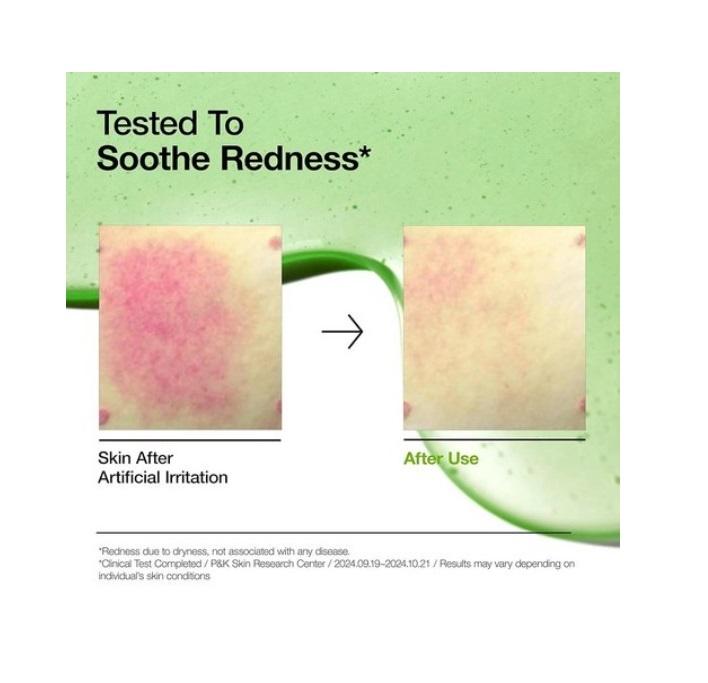 Anua Azelaic Acid 10 Hyaluronic Redness Soothing Serum Sensitive Skin Niacinamide Spot Care Natural Color Korean Skincare (30ml/ 1.01 Oz)