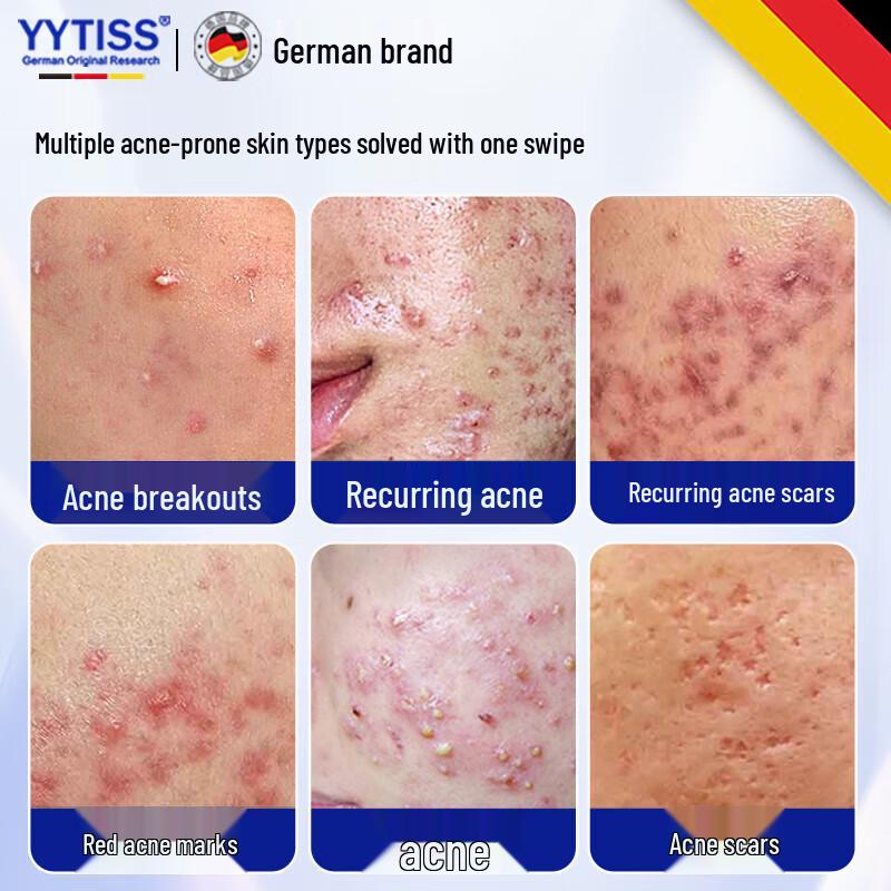 YYTISS Acne Treatment Cream